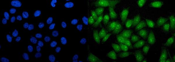 RTCD1/RTCA Antibody