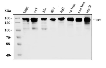 TJP2/ZO2 Antibody