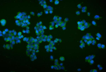 TRIM16 Rabbit Polyclonal Antibody