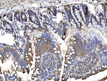 TRIM16 Rabbit Polyclonal Antibody