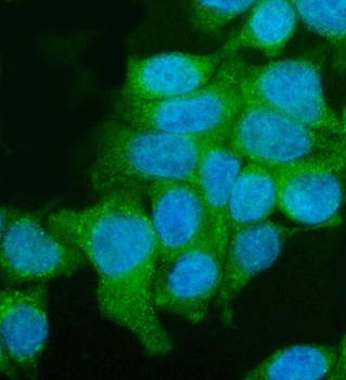 Utrophin/UTRN Rabbit Polyclonal Antibody
