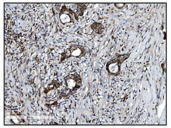 VAMP4 Rabbit Polyclonal Antibody