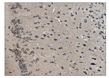 VAMP4 Rabbit Polyclonal Antibody