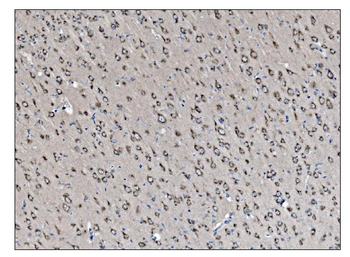 VAMP4 Rabbit Polyclonal Antibody