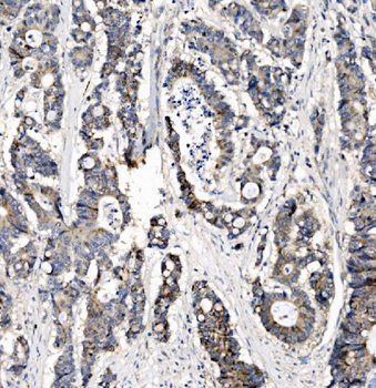 CHCHD10 Antibody