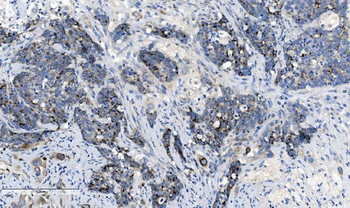 CHCHD10 Antibody