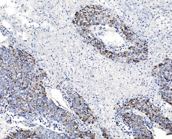 CHCHD10 Antibody