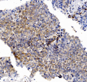 CHCHD10 Antibody