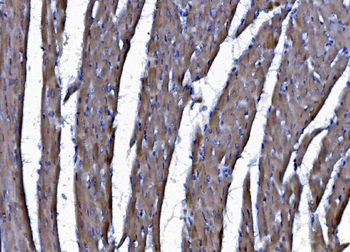 CHCHD10 Antibody