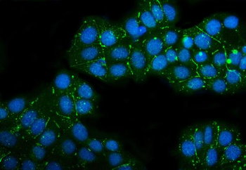 Claudin 3/CLDN3 Antibody