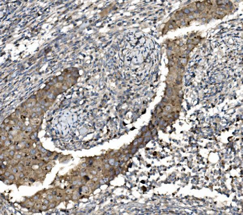 Claudin 3/CLDN3 Antibody