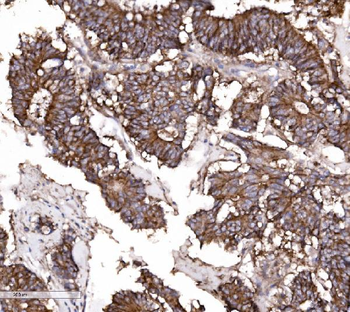 Claudin 3/CLDN3 Antibody