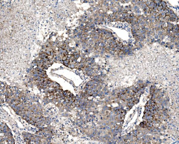Claudin 3/CLDN3 Antibody