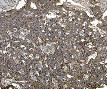 Claudin 3/CLDN3 Antibody