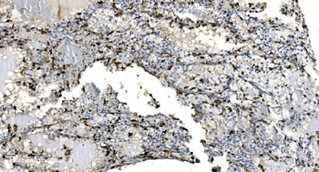 Coronin 1a/TACO/CORO1A Antibody