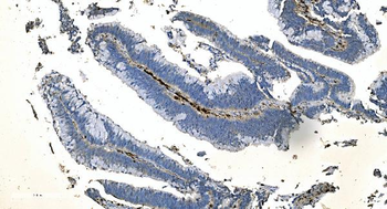 Coronin 1a/TACO/CORO1A Antibody