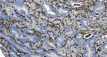 Coronin 1a/TACO/CORO1A Antibody