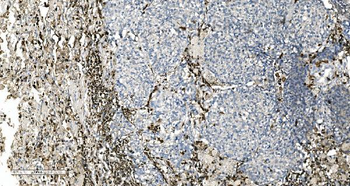 Coronin 1a/TACO/CORO1A Antibody