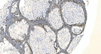 Coronin 1a/TACO/CORO1A Antibody
