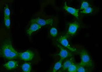 CYP51A1/CYP51 Rabbit Polyclonal Antibody