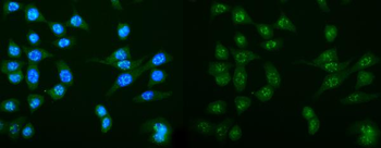DCTN1/p150-glued Antibody