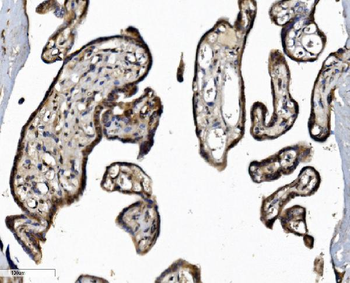 DCTN1/p150-glued Antibody