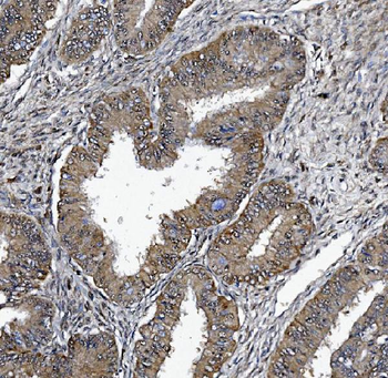 DCTN1/p150-glued Antibody