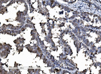 DYNLL1/PIN Antibody