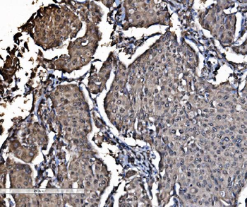 DYNLL1/PIN Antibody