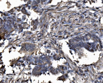 DYNLL1/PIN Antibody