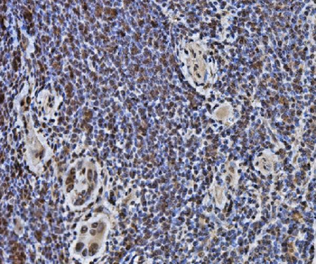 DYNLL1/PIN Antibody