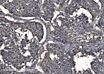 DYNLL1/PIN Antibody