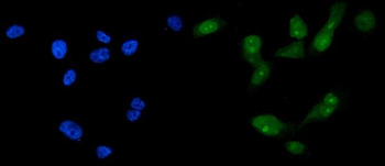 FOXA2 Rabbit Polyclonal Antibody