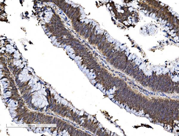 FOXA2 Rabbit Polyclonal Antibody