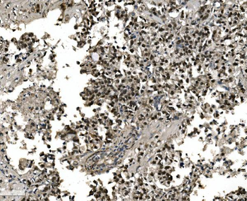 FOXA2 Rabbit Polyclonal Antibody