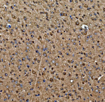 Aspartate Aminotransferase/GOT1 Rabbit Polyclonal Antibody