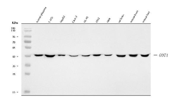 Aspartate Aminotransferase/GOT1 Rabbit Polyclonal Antibody