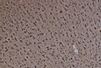 FABP-1/GOT2 Antibody