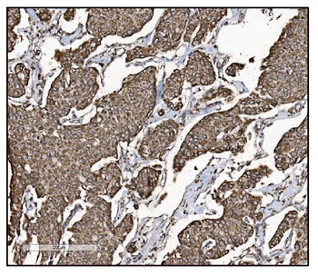 FABP-1/GOT2 Antibody