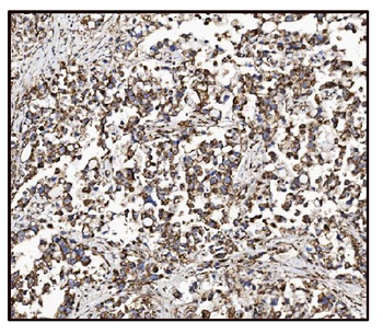 FABP-1/GOT2 Antibody