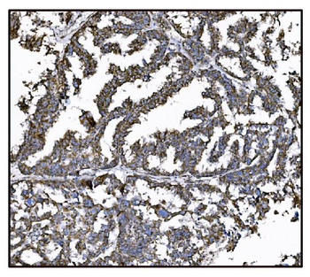 FABP-1/GOT2 Antibody