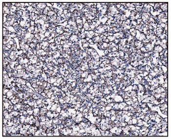 FABP-1/GOT2 Antibody