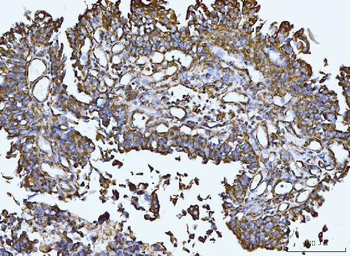 Integrin linked ILK Antibody