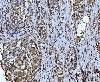 Integrin linked ILK Antibody