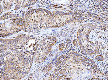 Integrin linked ILK Antibody