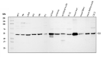 Integrin linked ILK Antibody