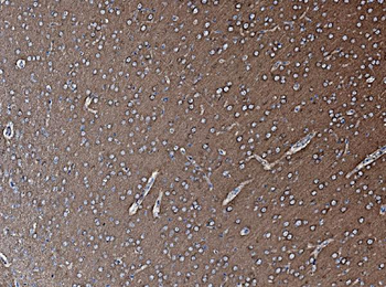 NSF Antibody