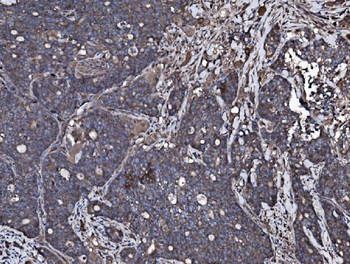 NSF Antibody