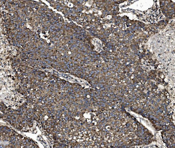 NSF Antibody