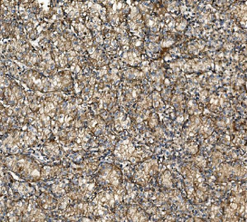 NSF Antibody